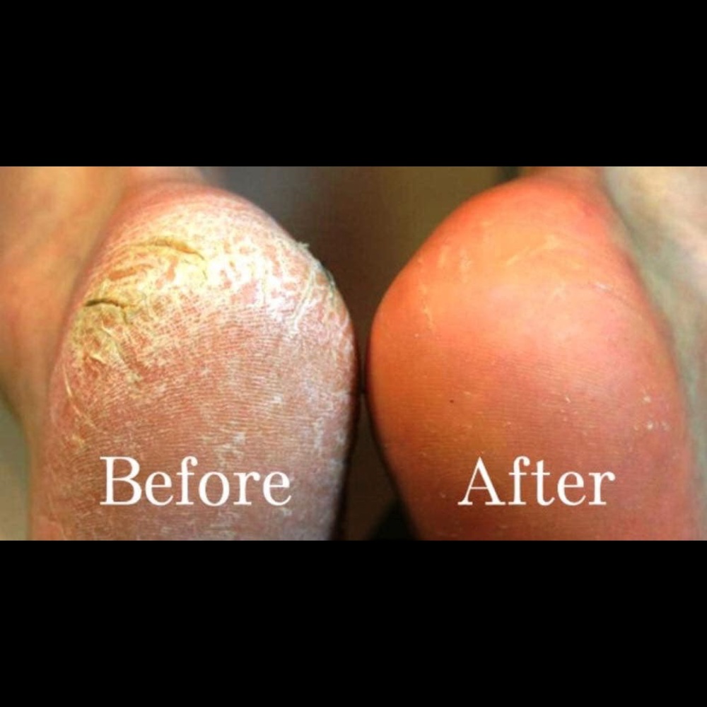 Sole Solution